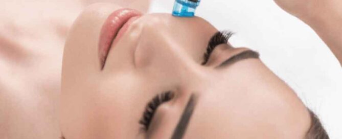 Microneedling